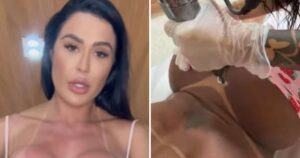 Gracyanne Barbosa inicia remoção de tatuagem íntima feita para Belo: ‘Não foi fácil’