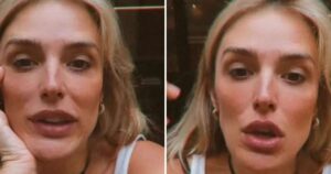 Rafa Brites revela diagnóstico difícil e relata sintomas da doença: ‘Toda marcada’