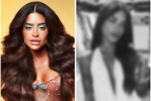 Aline Campos aparece pela primeira vez após cirurgia facial: “Disseram que eu não estaria liberada”