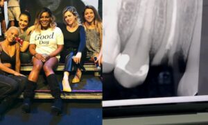 Ex-Rouge aparece banguela em pleno Carnaval e afirma: “Deus ajude a usar bastante essa boca”