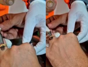 Homem machuca dedo em maçaneta e bombeiros precisam fazer corte; VEJA VÍDEO