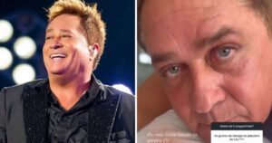 Poliana Rocha mostra resultado de cirurgia nos olhos de Leonardo: ‘Rejuvenesceu 10 anos’