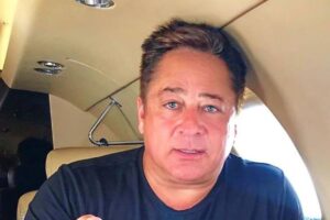 Leonardo surpreende ao mostrar resultado de cirurgia estética facial