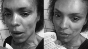 Lidi Lisboa é assaltada no Rio de Janeiro e sofre ferimentos no rosto