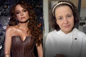 Alopecia androgenética: caso da cantora Maiara levanta alerta; entenda