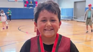 Menino de 9 anos fica com o rosto deformado após participar de desafio no Tiktok; veja antes e depois