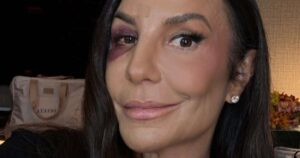 Ivete Sangalo recebe alta e tranquiliza fãs: ‘Já estou em casa’