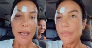 Ivete Sangalo recebe alta após desmaio e ferimentos no rosto