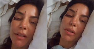 Internada, Ivete Sangalo aparece com rosto ferido e revela real estado de saúde