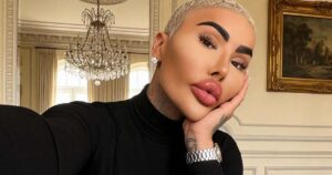 ‘Rei dos Lábios’: famoso influenciador é encontrado morto em hotel