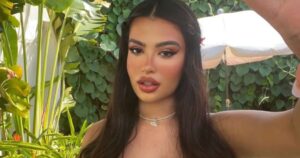 Aos 24 anos, influenciadora passa por cirurgia de rejuvenescimento; confira fotos