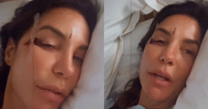 Ivete Sangalo mostra rosto com ferimentos após desmaiar em casa; cantora está internada em Salvador