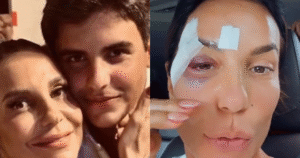 3 palavras simples, mas impactantes: o recado que Ivete Sangalo recebeu do filho, Marcelo, após desmaio, ferimentos no rosto e internação