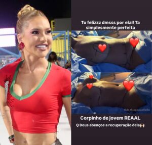 Virginia Fonseca surpreende ao mostrar antes e depois de cirurgia plástica da mãe, Margareth Serrão