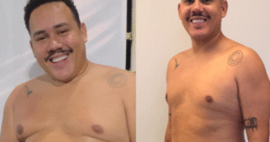 Ex-BBB Lucas Buda impressiona com antes e depois após perder 31 quilos