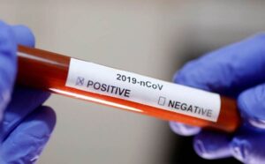 Nova pandemia? Vidente revela sonho e faz pedido: ‘Por favor!