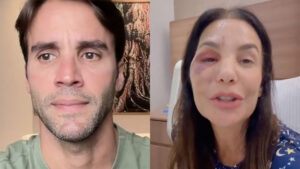 Ex-marido de Ivete Sangalo revela contato com ela após cirurgia: ‘Um grande susto’