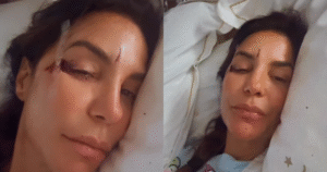 Ivete Sangalo é internada e mostra rosto machucado