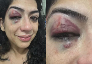 Mulher é agredida por dona de bar em briga por cigarro; saiba mais