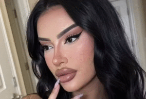 Influenciadora diz que precisou trocar passaporte três vezes após mudanças no rosto