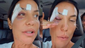 Ivete Sangalo detalha diagnóstico dado por médicos após desmaio e internação: ‘No meu caso…’