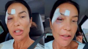 Ivete Sangalo comemora alta hospitalar após desmaio e brinca: ‘Maquiagem diferente’