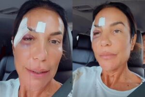 Ivete Sangalo recebe alta de internação após desmaio