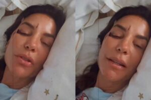 Famosos amparam Ivete Sangalo após acidente: “Vai ficar tudo bem!”