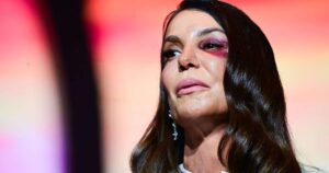 Ivete Sangalo faz primeiro show após acidente e explica: ‘Fiz questão de vir assim’