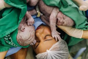 Influenciadora Bruna Lohaine dá à luz gêmeos após sobreviver a parada cardíaca