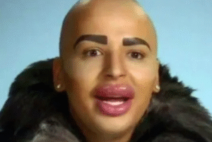 Influenciador conhecido como “Rei dos Lábios” morre aos 34 anos