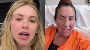 Mesmo com dinheiro, Virginia explica por que a mãe demorou para fazer cirurgias: ‘Esforço’