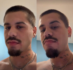 Zé Felipe se machuca ao mudar visual e brinca com resultado: Parecendo um bode