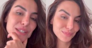 Esposa de Rodrigo Santoro, Mel Fronckowiak faz alerta ao sofrer fraturas na coluna após queda