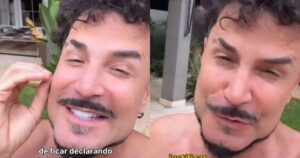 Latino reage após virar alvo de críticas sobre harmonização facial: ‘Parem com essa hipocrisia’