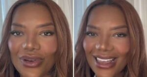 O que aconteceu com Ludmilla? Especialistas fazem alerta sobre novo rosto da cantora: