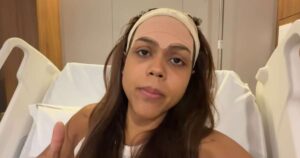 Igual à Anitta? Camila Loures faz cirurgia no rosto e revela detalhes de decisão