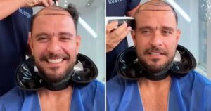 Diogo Nogueira raspa a cabeça e fãs suspeitam procedimento: ‘Não faça’