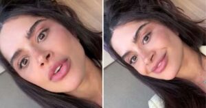 Após lifting facial, Aline Campos revela mais uma plástica secreta: ‘Vocês não sabiam’