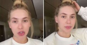 Olho caído e sofrimento: Virginia Fonseca revela nova crise após atrasar tratamento: ‘Dor’