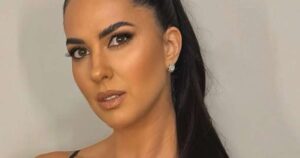 Graciele Lacerda choca com transformação radical do rosto após procedimentos