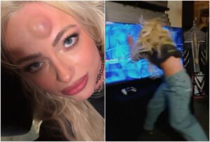 Vídeo: Estrela de luta livre exibe galo na testa após ser arremessada em TV