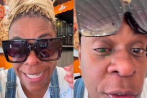 Após uso de produto capilar, Cacau Protásio tem reação alérgica grave nos olhos