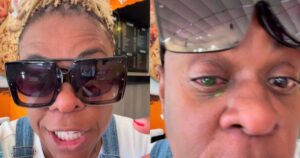 Cacau Protásio relata problema grave no olho e perda temporária da visão após uso de pomada capilar