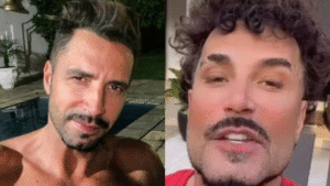 Latino surge com rosto harmonizado e resultado chora a web: “Nem parece”