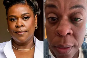 Atriz tem cegueira temporária após uso de pomada capilar; quais os riscos?