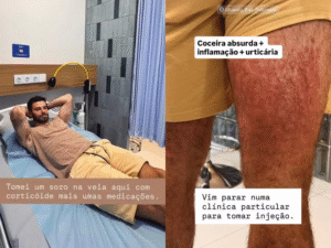 Ator brasileiro é hospitalizado na Indonésia após ataque de ácaros