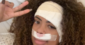 Marvvila passa por cirurgia para remoção de tumor no ouvido e tem estado de saúde atualizado; confira