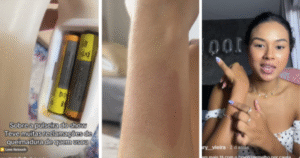 Fãs de Luan Santana relatam queimaduras após uso de pulseiras em show em BH