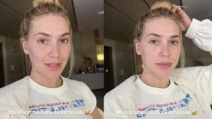 Virginia volta a sofrer com crise de dores na cabeça e descobre motivo; veja qual